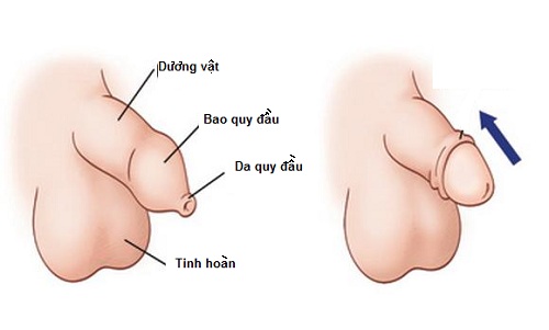 bao quy đầu không tụt bao quy đầu không tụt
