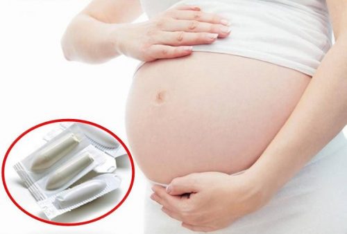 Ngứa vùng kín khi mang thai có nên đặt thuốc không?