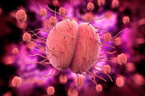 Bệnh lậu ở nam giới do vi khuẩn cầu lậu Neisseria gonorrhoeae gây viêm nhiễm